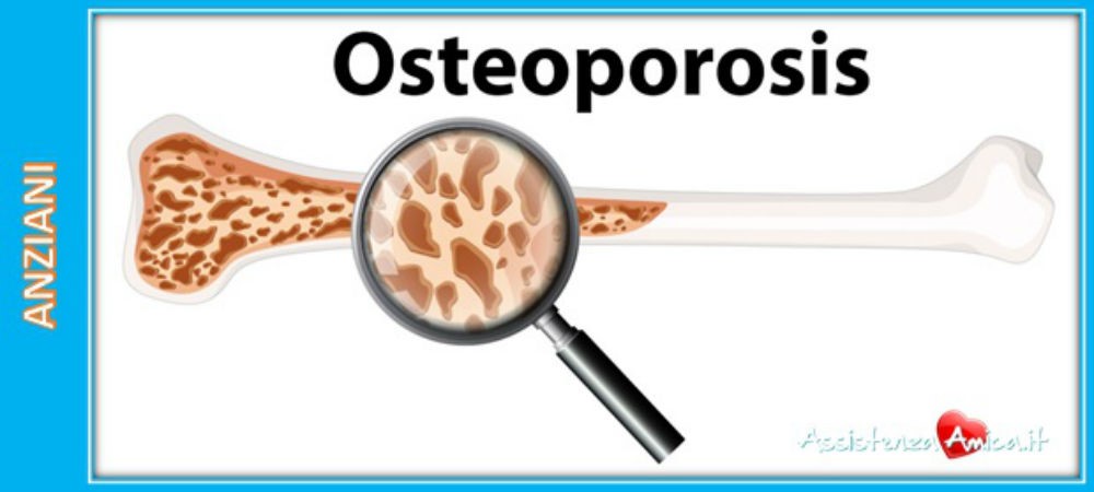L’osteoporosi