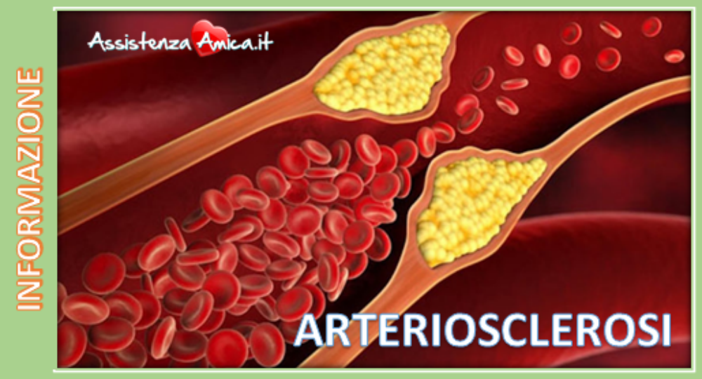 ARTERIOSCLEROSI