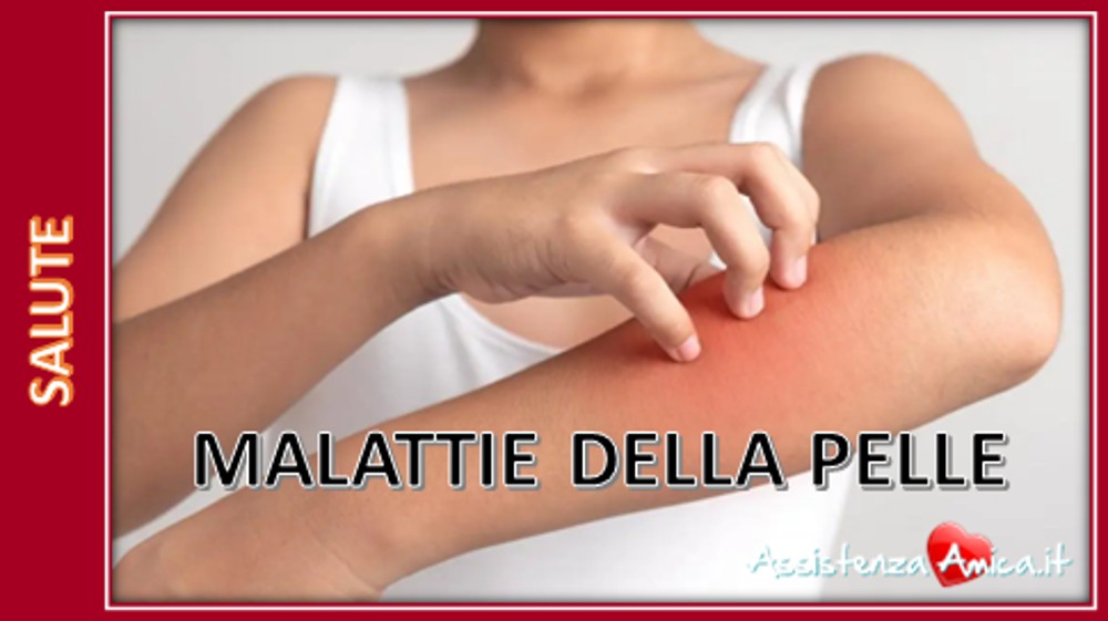 Cosa sono le malattie della pelle?