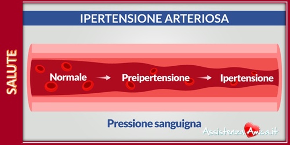 L’ipertensione arteriosa